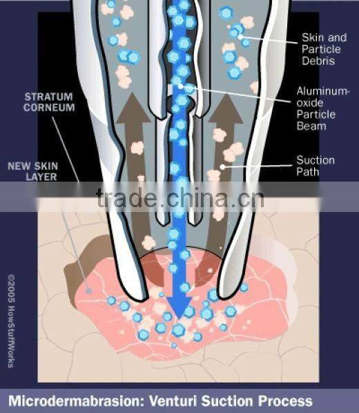 micro crystal diamond dermabrasion machine with auto clean