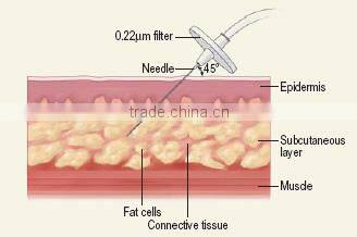 fast beauty device!!!CDT CO2 carboxy equipment/carboxy therapy machine
