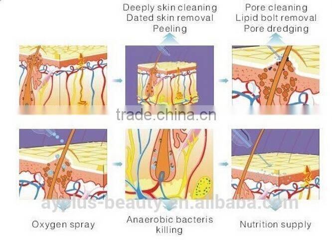 AYJ-Y75(CE)oxygen cylinder filling machine/oxygen producing machine/portable oxygen breathing machine
