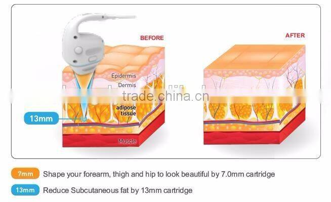 g5 weight loss electric machine /ultrasonic wave weight loss machine