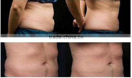 Best 5 in 1 Portable Popular Weight Loss Multipolar RF Vacuum Cavitation Machine