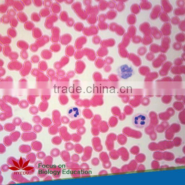 High quality 18pcs blood test prepared slides set