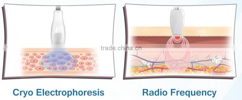 Perfect electroporation skin tightening rf mesoterapia beauty device - New Cellactor