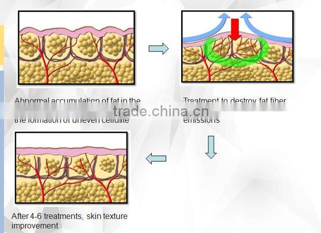 Whole sale weight loss belt for distrubutor
