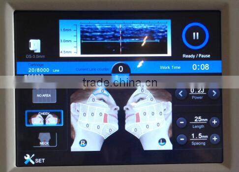 2015 anti wrinkle machine korea hifu