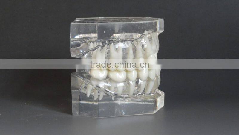 Malocclusion Classification Demonstration Model 1