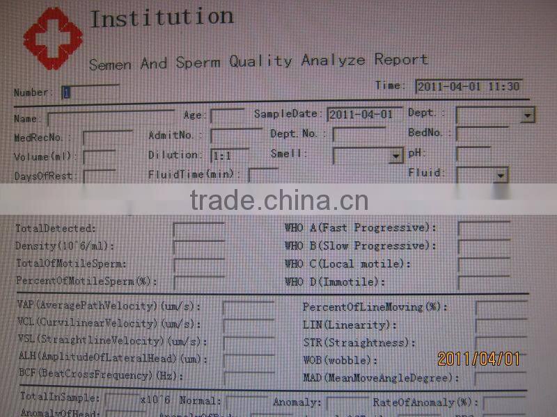 Sperm analyzer(tr-3000)