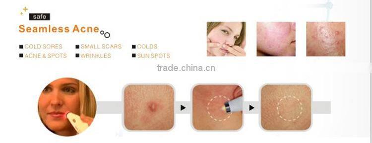 economic acne removal black head white head removal machine for sale