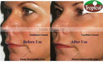 100 % NATURAL VIRGIN COCONUT OIL