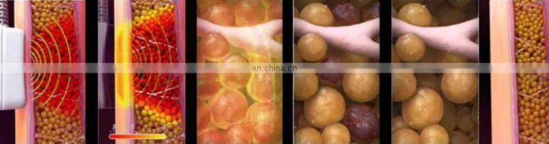 2022 Popular 10 Handles Hot Sculpting body shaping machine/ RF skin tightening machine/ Jisu ID fat dissolving machine