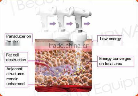 laser weight loss ultrasound weight loss machine