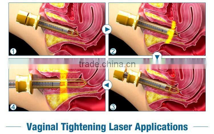 Multifunction laser co2 fractional laser skin treatment machine treatment for face and body