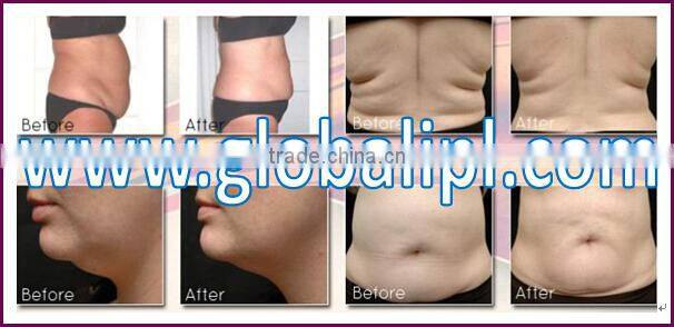2015 buy chinese products online butt vacuum therapy