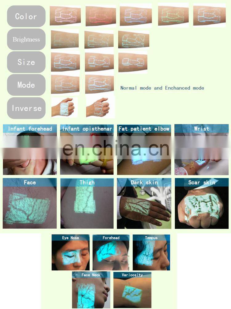 HC-G037  High quality Near Infrared Light portable handheld Vein Finder with support