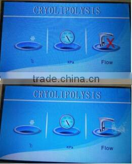 -16 degree cooling effect criolipolysis/cryotherapy fat freeze machine celulite removal