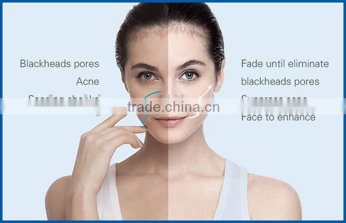 2017 new design 5 in 1 face lifting home beauty equipment