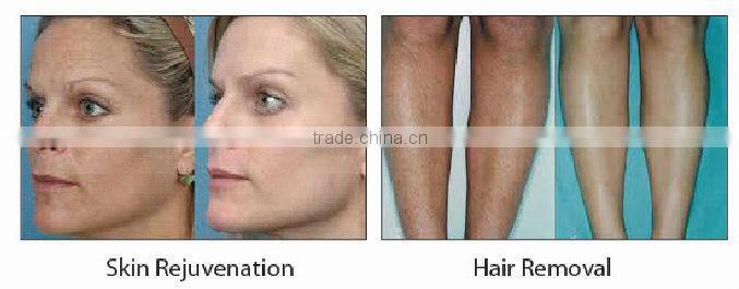 2012 laser hair remover for face and body ipl machine laser beauty home use personal epilater or depilator P003