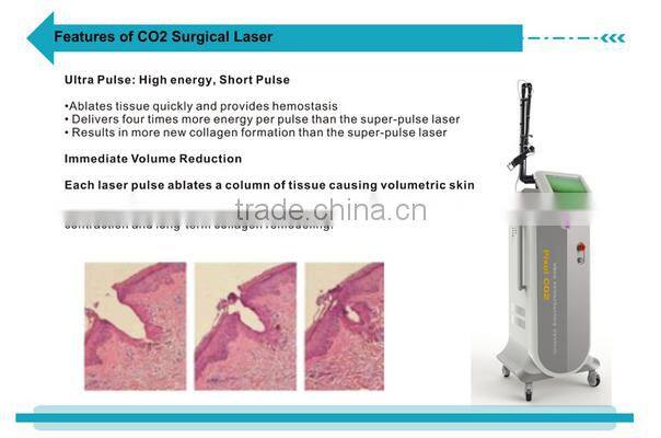 New Year promotion CO2 fractional laser vaginal tightening scar removal machine with CE--CV-II