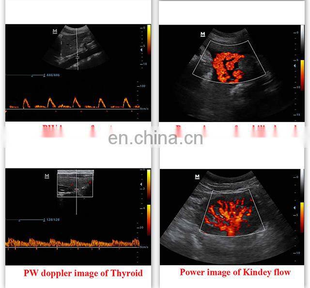 Good Quality Original Mindray DP-30 BW Portable Full digital ultrasound device Mindray DP 30 ultrasound machine