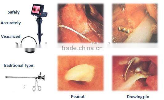 2.2 mm Working Channel Flexible Video Medical Endoscope Camera Endoscopy Compare Fiber Optic Video Olympus Bronchoscope