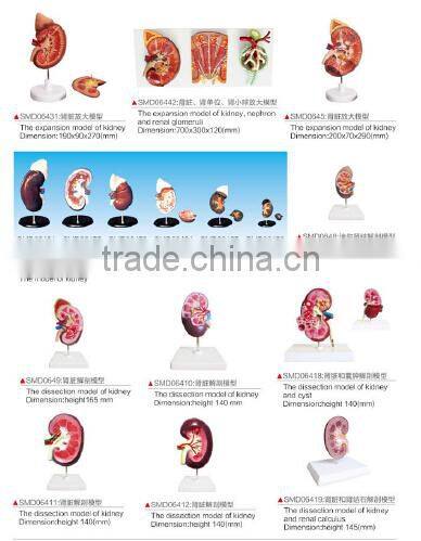 Kidney enlarge anatomy model