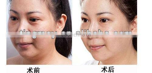 4 In 1 portable home beauty instrument suppliers tm-264