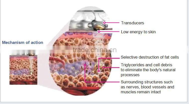 Advanced ultra body shape contouring machine on sale