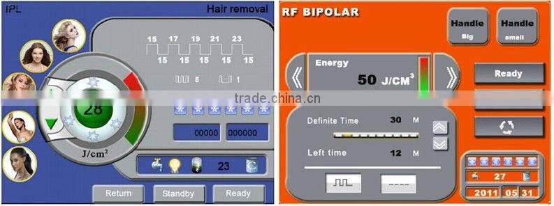 2015 Best ipl device with 2 handles (CE,ISO,BV)