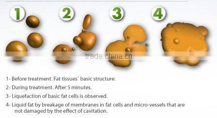 Lowest prices mini multifunctional treatment heads for fat resuction and skin tightening power slim vibration machine