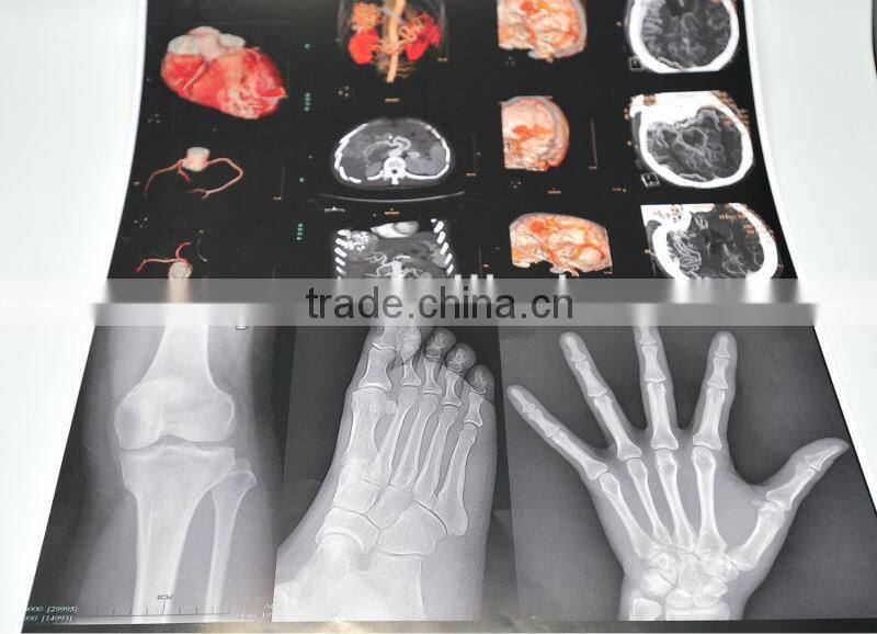 For Epson Waterbased Pigment Ink for Uncoated Film Plate Making