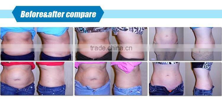hot sale!!! cavitation rf vacuum slimming machine with multifunction 6 in 1