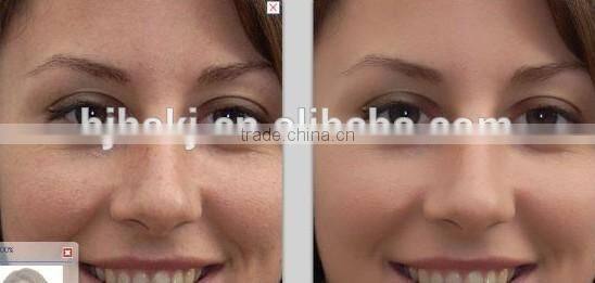 Promotion new technology Clinic use hair removal devices ipl/hair removal shr ipl