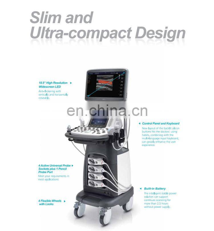 Trolly stand Sonoscape 4D Color Doppler Ultrasound Machine/Sonoscape S22