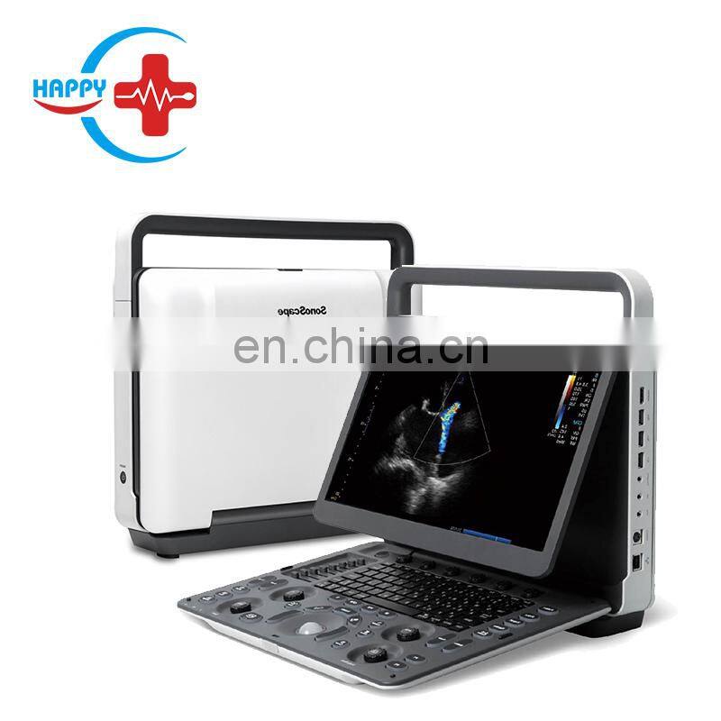 Hot Sale Sonoscape E3 Portable 15 Inch LCD Laptop Ultrasound Device Color Doppler Ultrasound Machine
