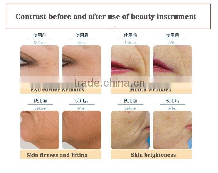 No Needle EMS Electroporation beauty instrument EMS RF beauty machine Skin Tightening Face Lifting easy to use