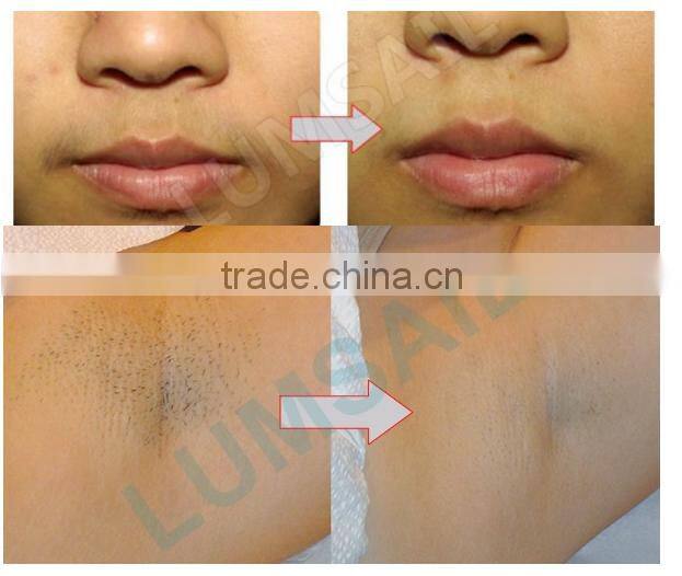 beauty salon machine 2 handles shr opt ipl hair removal