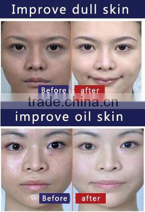 micro needle electrical derma pen &skin needling pen