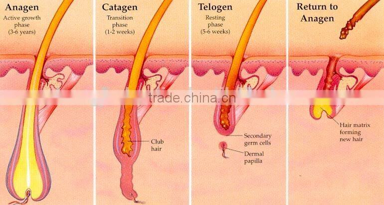 new design 3 machine in one set / SHR IPL Permanent Hair Removal Machine