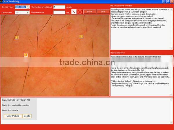 2014 Newest 3D Skin Analyzer