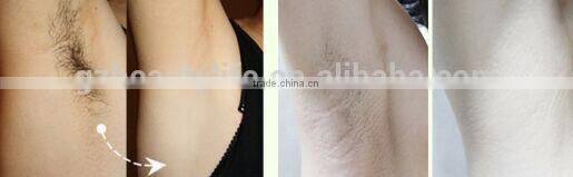 2015 newest salon use mini shr IPL intense pulse light hair removal machine