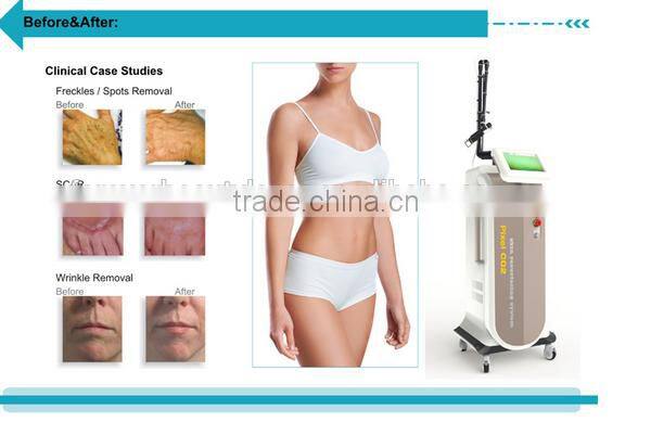 New Year promotion CO2 fractional laser vaginal tightening scar removal machine with CE--CV-II