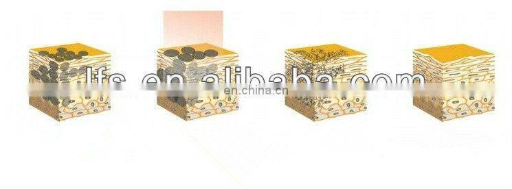 Switch ND YAG Laser price/tatto removal machine/ q swithed laser