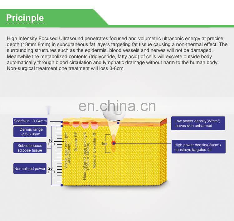 Renlang vertical liposonic slimming machine for body/Waist weight lost with 8mm and 13mm head