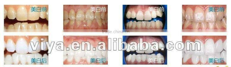 The best medical laser teeth whitening machine