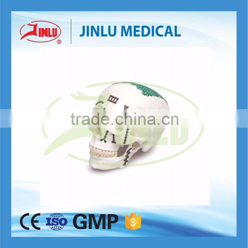 24 hours feedback Advanced surface treatment L-shaped Plate(110 degree L/R Type),orthopedic titanium plate,skull plates.