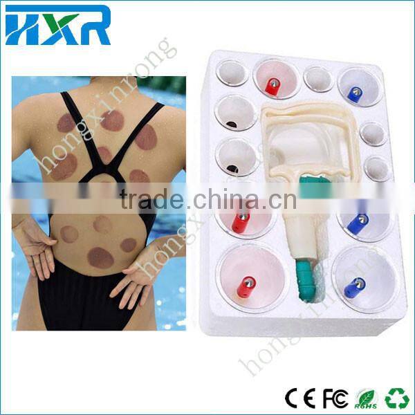 Chinese Traditional Manual Vacuum cupping massage for sportman
