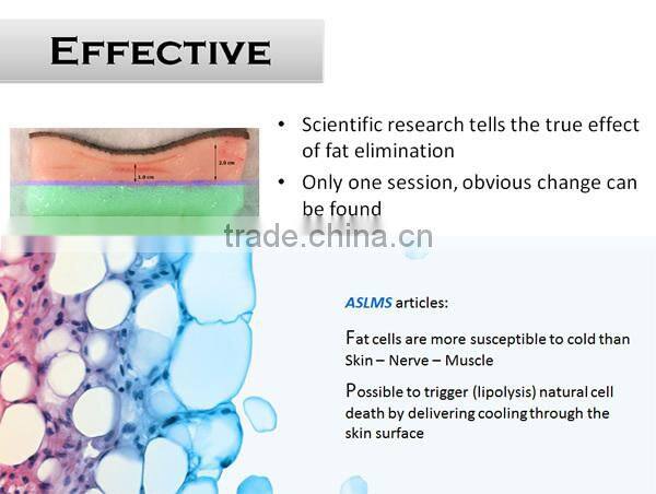 Cool slim therapy body sculpting machine