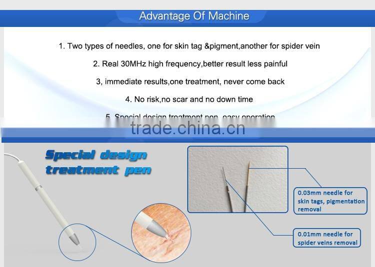 Ultrasound vascular stent spider vein removal face black spot remover machine