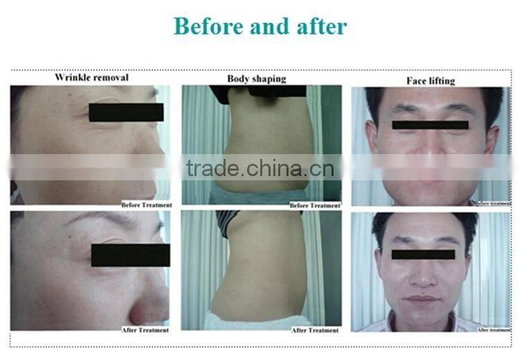 Weight Losing Body Shaping Product