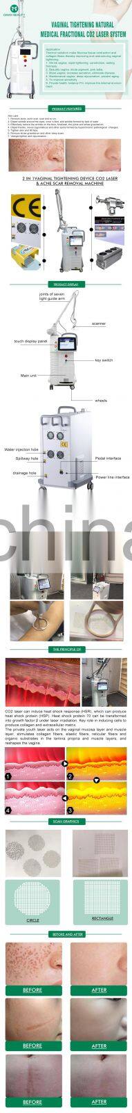 China best vaginal treatment co2 fractional laser with RF tube fractional co2 RF equipment / co2 laser Carbon diode laser